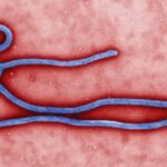 Ilustrasi partikel virus Ebola di bawah mikroskop elektron