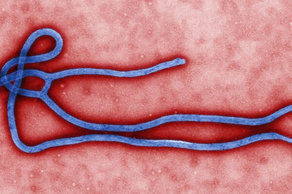 Ilustrasi partikel virus Ebola di bawah mikroskop elektron