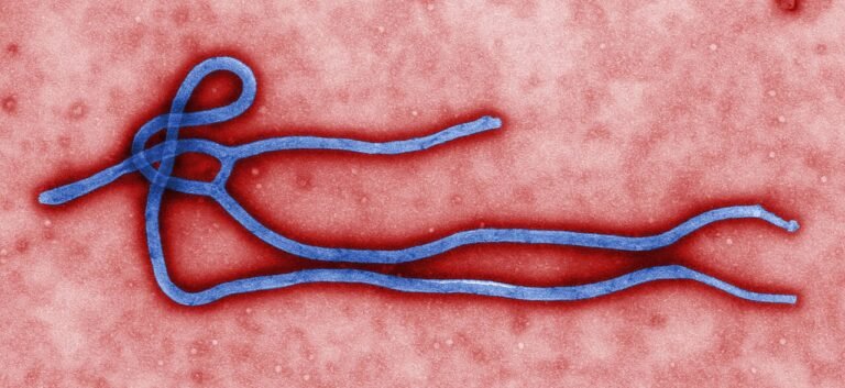Kasus Ebola di Kenya Bertambah Jadi 8, Petugas Kesehatan Ikut Tertular
