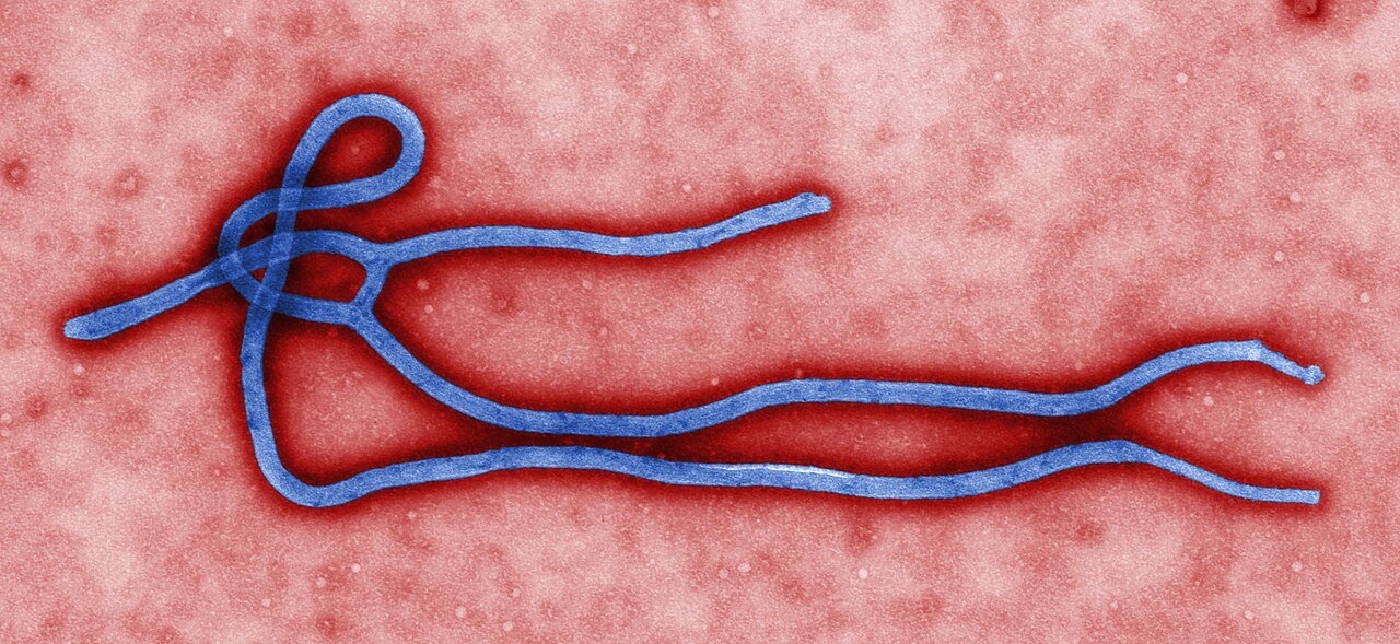 Ilustrasi partikel virus Ebola di bawah mikroskop elektron